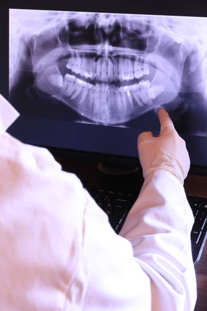 Best Emergency Dental Care for Broken or Chipped Teeth in Warrenton, MO